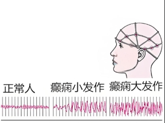 С�����ķ�������